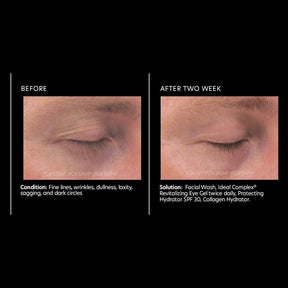 PCA Skin Ideal Complex® restorative eye cream 14g