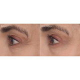 Murad Retinal ReSculpt Eye Treatment