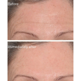 Murad Targeted Wrinkle Corrector