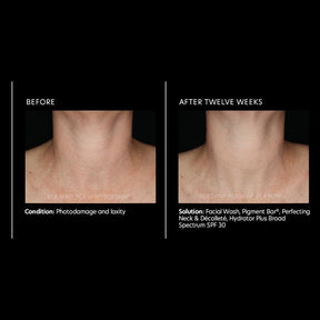 PCA Skin Perfecting Neck and Decollete 85g